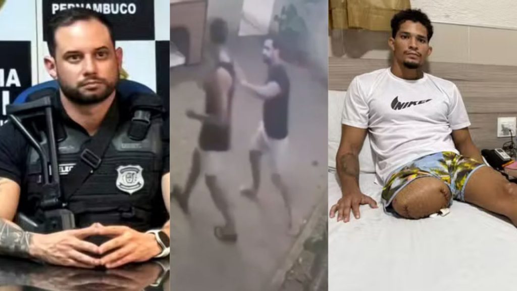 Delegado que atir0u em ambulante e causou amputação da perna vira réu por tentativa de h0micídi0