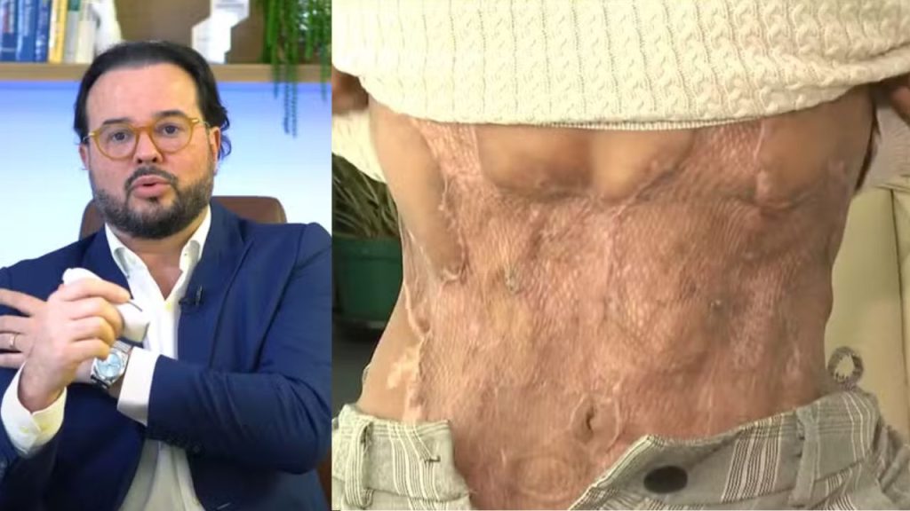 Médico é condenado a 5 anos de prisão por cirurgia 'X-Tudo' que deformou paciente