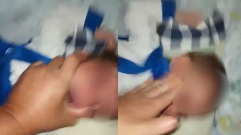 x(14)
